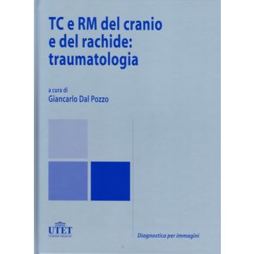 TC e RM del Cranio e del Rachide: Traumatologia [Dal Pozzo Giancarlo - Utet Medica]