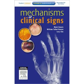 Mechanisms of Clinical Signs