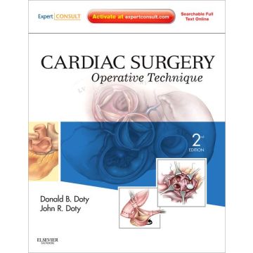 Cardiac Surgery, 2nd Edition - OPERATIVE TECHNIQUE - EXPERT CONSULT: ONLINE AND PRINT  [Doty  - ELSEVIER SCIENCE]