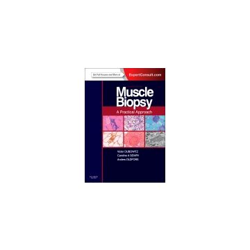 Muscle Biopsy: A Practical Approach, 4th Edition - Expert Consult; Online and Print  [Dubowitz  - Elsevier Science]