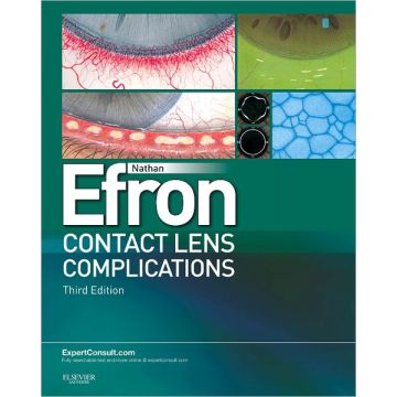 Contact Lens Complications, 3rd Edition - EXPERT CONSULT - ONLINE AND PRINT  [Efron  - Elsevier Science]
