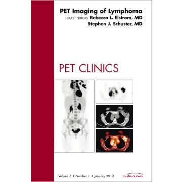 PET Imaging of Lymphoma, An Issue of PET Clinics  [Elstrom  - Elsevier Science]