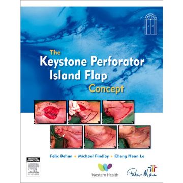 The Keystone Perforator Island Flap Concept