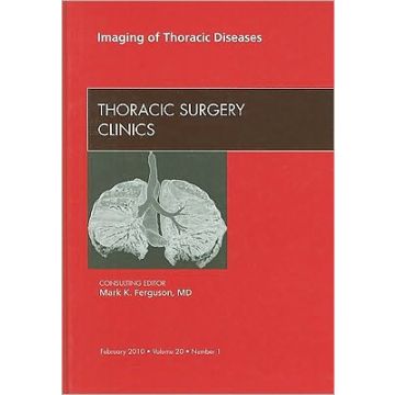 Imaging of Thoracic Diseases, An Issue of Thoracic Surgery Clinics Volume 20-1