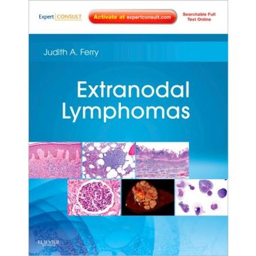 Extranodal Lymphomas - Expert Consult - Online and Print