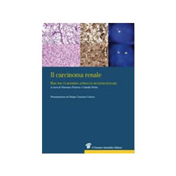 Il carcinoma renale. Basi per un moderno approccio multidisciplinare