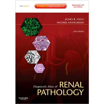 Diagnostic Atlas of Renal Pathology, 2nd Edition - EXPERT CONSULT - ONLINE AND PRINT  [Fogo  - Elsevier Science]