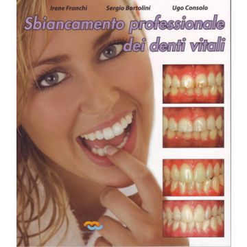 Sbiancamento professionale dei denti vitali