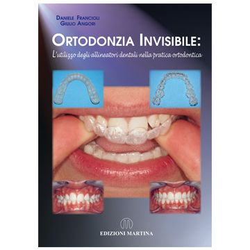 Ortodonzia Invisibile: L’utilizzo degli allineatori dentali nella pratica ortodontica    [Francioli - Martina Edizioni]