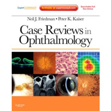 Case Reviews in Ophthalmology - EXPERT CONSULT - ONLINE AND PRINT  [Friedman  - ELSEVIER SCIENCE]