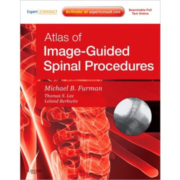 Atlas of Image-Guided Spinal Procedures - EXPERT CONSULT - ONLINE AND PRINT   [Bruce  - Elsevier Science]