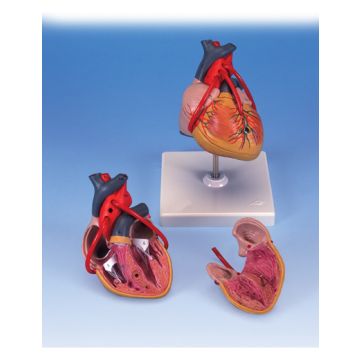 Cuore, modello classico, con bypass, in 2 parti