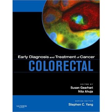 Early Diagnosis and Treatment of Cancer Series: Colorectal Cancer - EXPERT CONSULT - ONLINE AND PRINT
