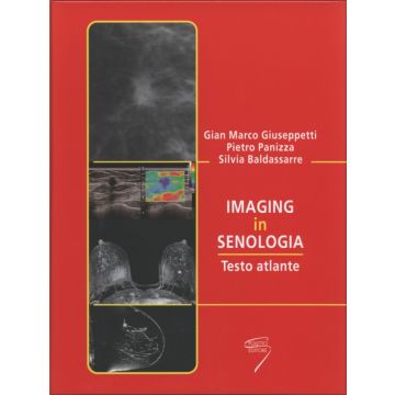 Imaging in senologia gian marco giuseppetti panizza poletto editore libro