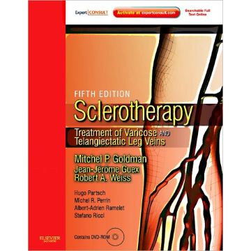 Sclerotherapy Expert Consult - Online and Print, 5th Edition - Treatment of Varicose and Telangiectatic Leg Veins, Text with DVD