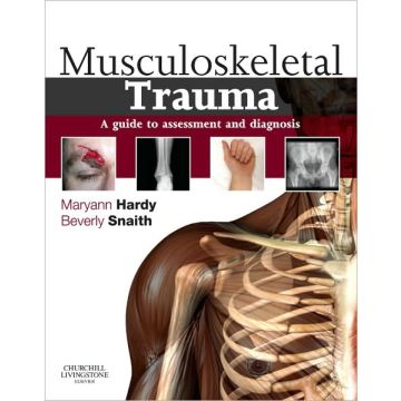 Musculoskeletal Trauma - a guide to assessment and diagnosis
