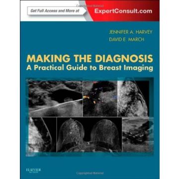 Making the Diagnosis: A Practical Guide to Breast Imaging - Expert Consult - Online and Print  [Harvey  - Elsevier Science]