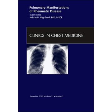 Pulmonary Manifestations of Rheumatic Disease, An Issue of Clinics in Chest Medicine