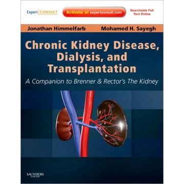 Chronic Kidney Disease, Dialysis, and Transplantation, 3rd Edition - A Companion to Brenner and Rector's The Kidney - Expert Consult: Online and Print