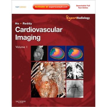 Cardiovascular Imaging, 2-Volume Set - EXPERT RADIOLOGY SERIES EXPERT CONSULT- ONLINE AND PRINT