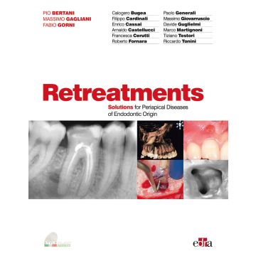 Retreatments. Solutions for periapical diseases of endodontic origin