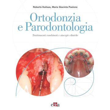Ortodonzia e parodontologia kaitsas paolone edra