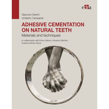 Adhesive cementation on natural teeth. Materials and techniques