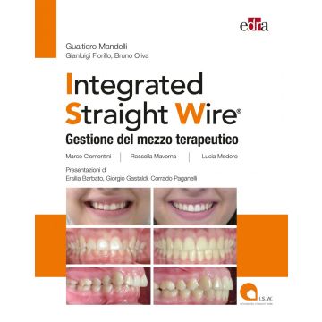 Integrated straight wire. Gestione del mezzo terapeutico
