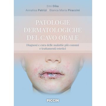 Patologie dermatologiche del cavo orale. Diagnosi e cura delle malattie più comuni e trattamenti estetici