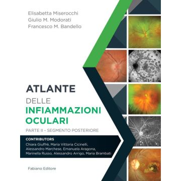 Miserocchi Atlante delle infiammazioni oculari parte 2 segmento postetiore fabiano editore