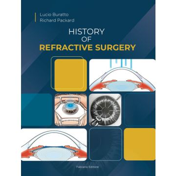 History of refractive surgery