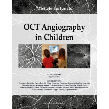 OCT. Angiography in children