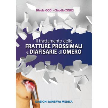 Il trattamento delle fratture prossimali diafisarie di omero