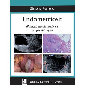 Endometriosi diagnosi terapia medica e chirurgica simone ferrero seu società editrice universo
