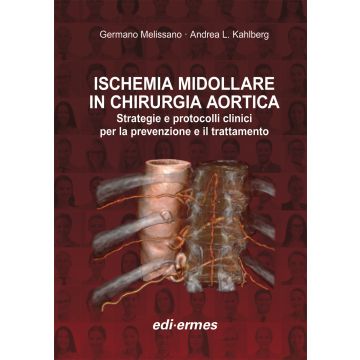 Ischemia Midollare in Chirurgia Aortica. Strategie e protocolli clinici per la prevenzione e il trattamento