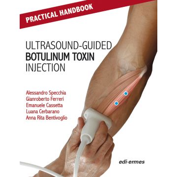Practical handbook for ultrasound-guided botulinum toxin injection
