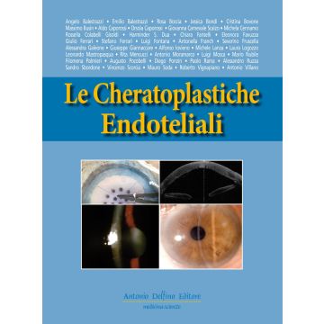 Le cheratoplastiche endoteliali
