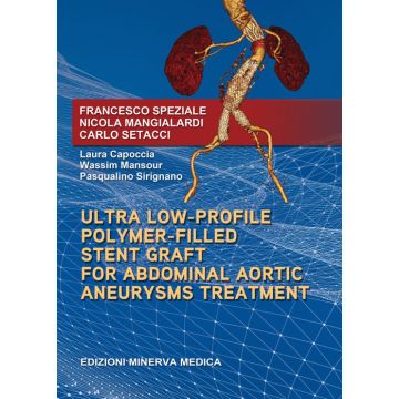 Ultra low-profile polymer-filled stent graft for abdominal aortic aneurysms