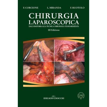 Chirurgia Laparoscopica Corcione Franco Miranda Ruotolo idelson Gnocchi