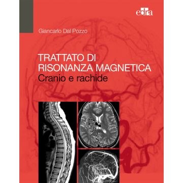 Trattato di Risonanza Magnetica (RM). Cranio e rachide