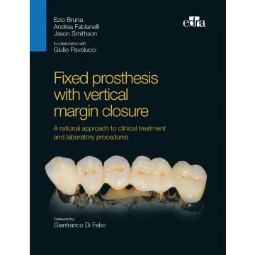 Fixed prosthesis with vertical margin closure. A rational approach to clinical treatment and laboratory procedures