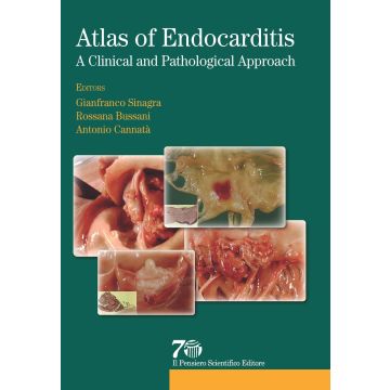 Atlas of endocarditis. A clinical e pathological approach