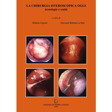 La Chirurgia Isteroscopica oggi. Tecnologia e realtà. Con DVD (Isteroscopia ginecologica)