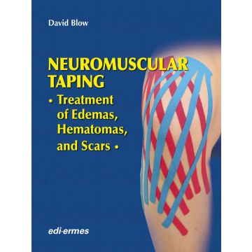 Neuromuscular taping. Treatment of edemas, hematomas and scars