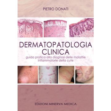 Dermatopatologia clinica. Guida pratica alla diagnosi delle malattie infiammatorie della cute