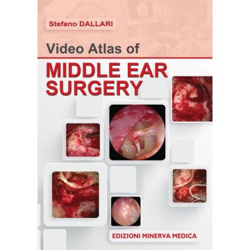 Video atlas of middle ear surgery
