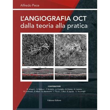 L'angiografia OCT dalla teoria alla pratica