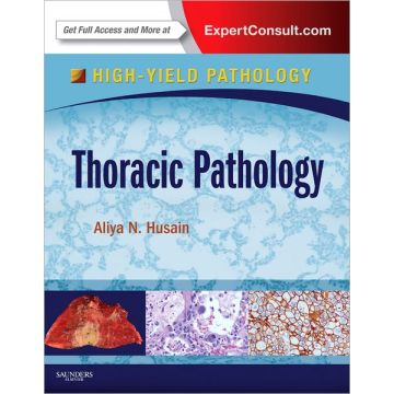 Thoracic Pathology - A VOLUME IN THE HIGH YIELD PATHOLOGY SERIES (EXPERT CONSULT - ONLINE AND PRINT)   [Husain - Elsevier Science]