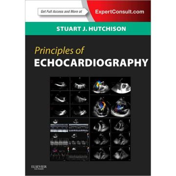 Principles of Echocardiography and Intracardiac Echocardiography - EXPERT CONSULT - ONLINE AND PRINT   [Hutchison  - Elsevier Science]