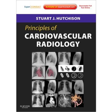 Principles of Cardiovascular Radiology - EXPERT CONSULT - ONLINE AND PRINT  [Hutchison - Elsevier Science]